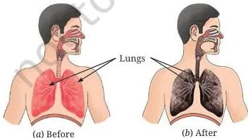 Comparison of healthy lungs with lungs darkened by prolonged beedi or cigarette smoke, the chapter’s strongest visual argument for saying no to addictive substances
