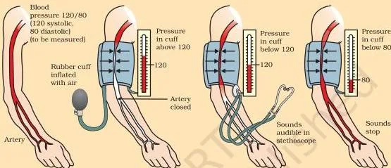 The force that blood exerts against the wall of a vessel is called blood pressure.
